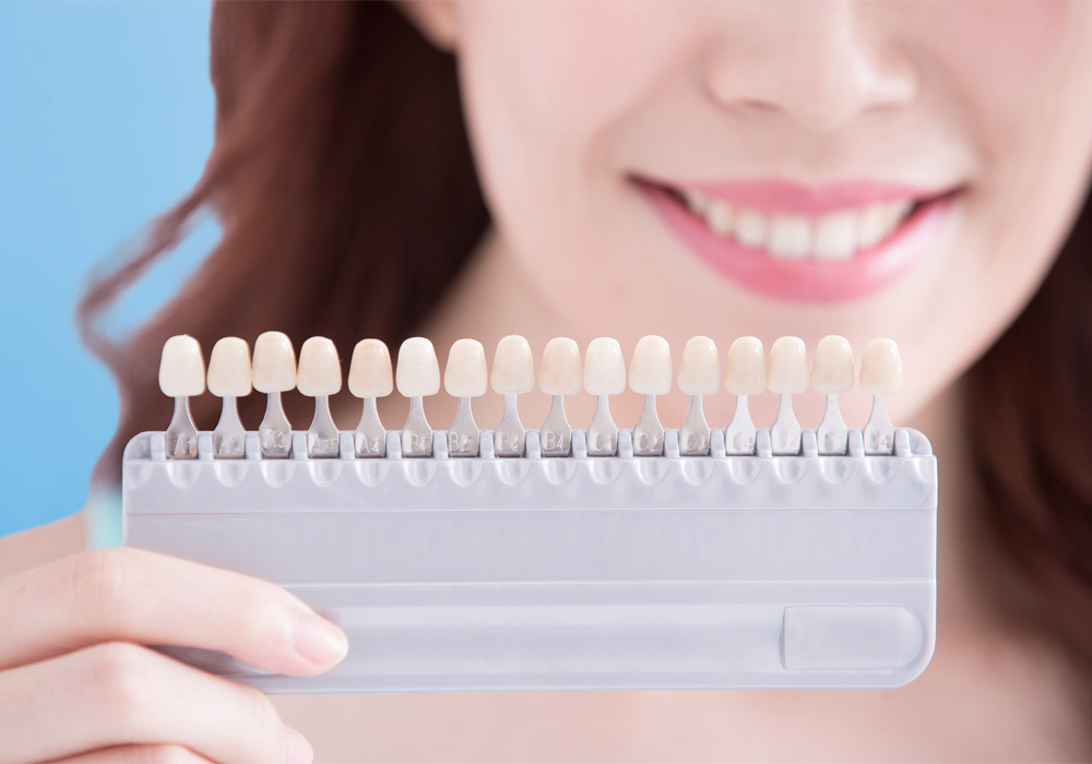 Dental Bonding Edmonton